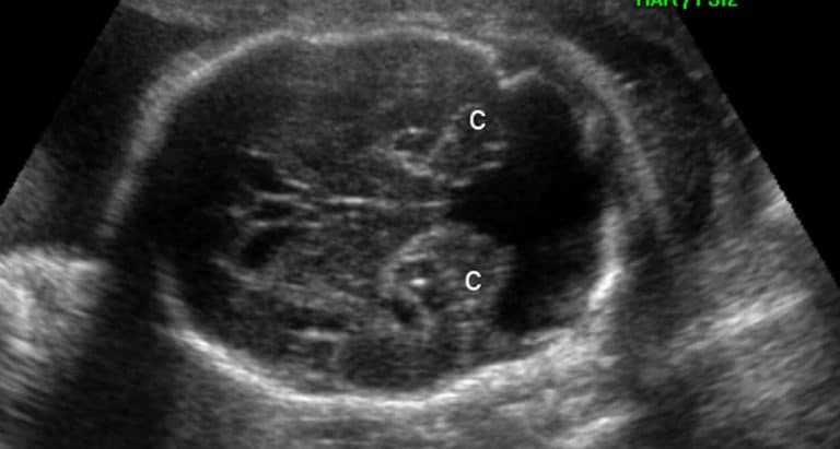 Snc Fetalmed Medicina Fetal Em Curitiba 