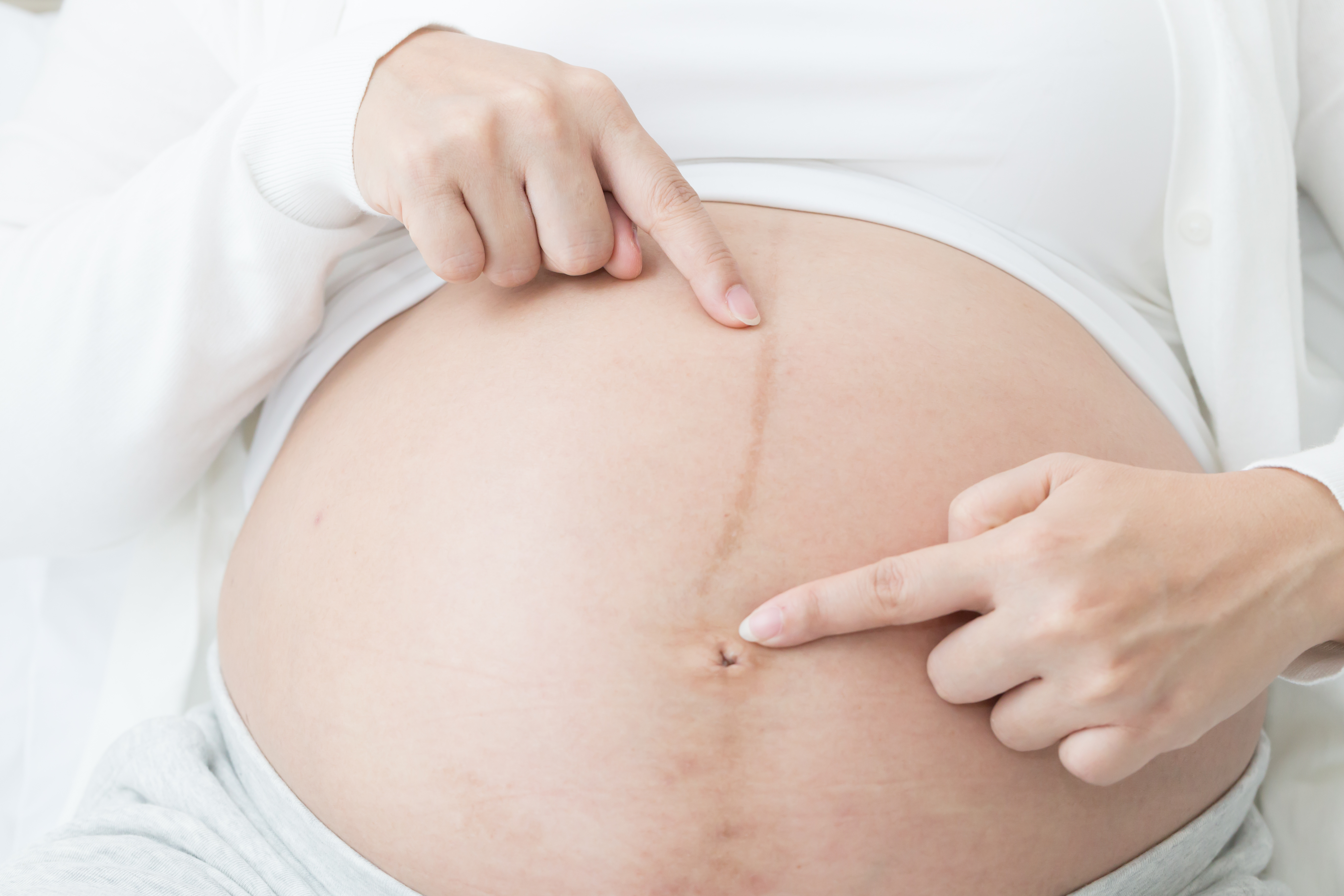 Sintomas de gravidez  Os 5 primeiros sinais de que você está grávida 