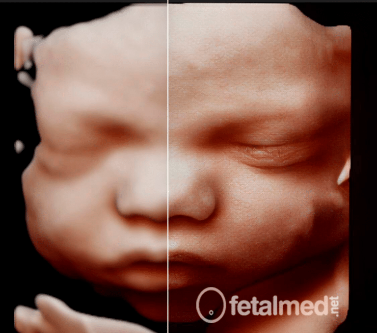 Aplicativo Fetalmed Medicina Fetal Em Curitiba 