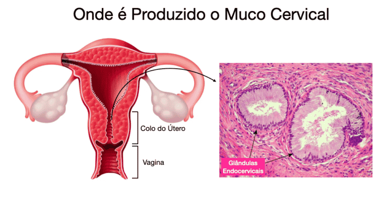 Muco Cervical Suas Varia Es E Como Identificar A Ovula O