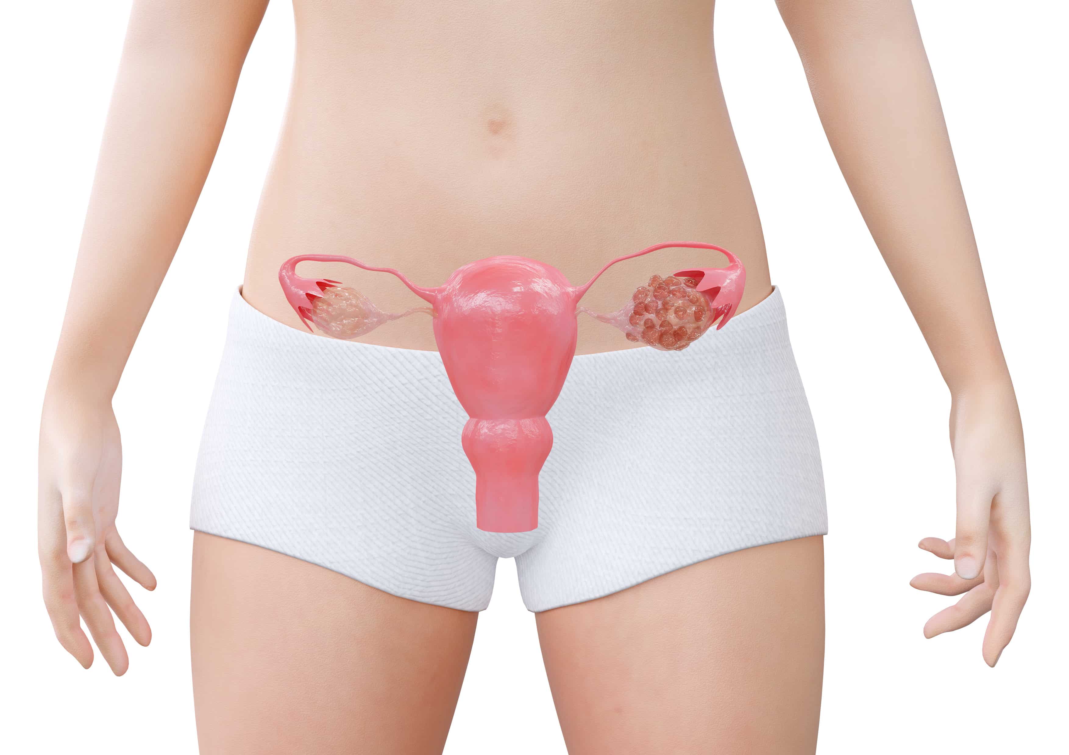 Ciclos Menstruais Desregulados